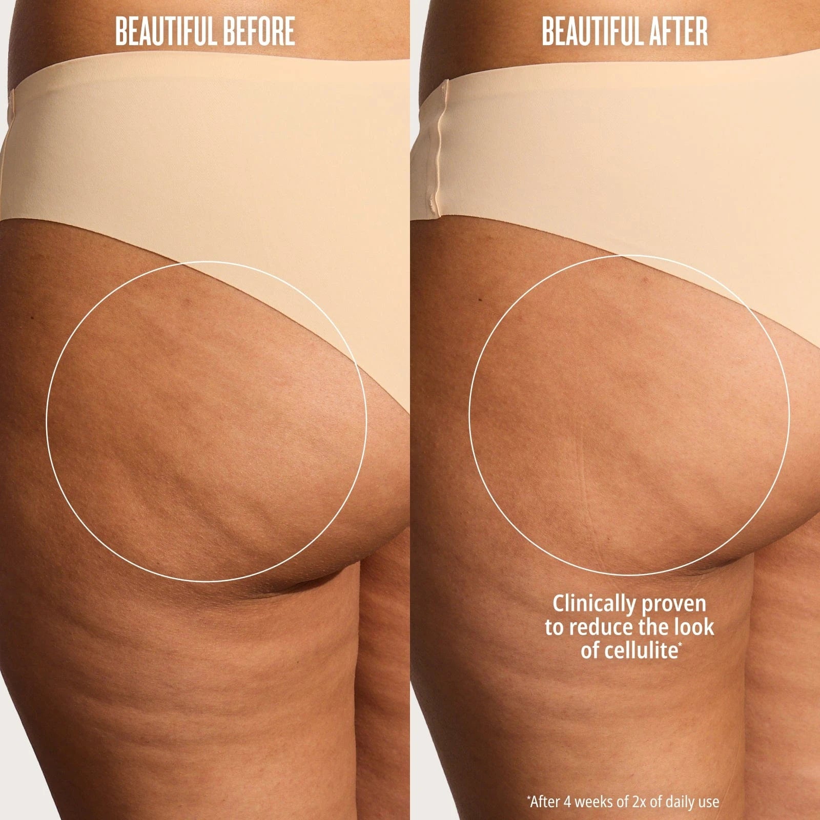 beautiful beforem beautiful after. clinically proven to reduce the look of cellulite* 
*after 4 weeks of 2x of daily use